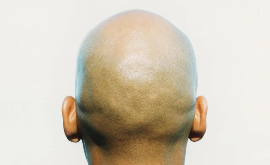 how to get a shiny bald head 7