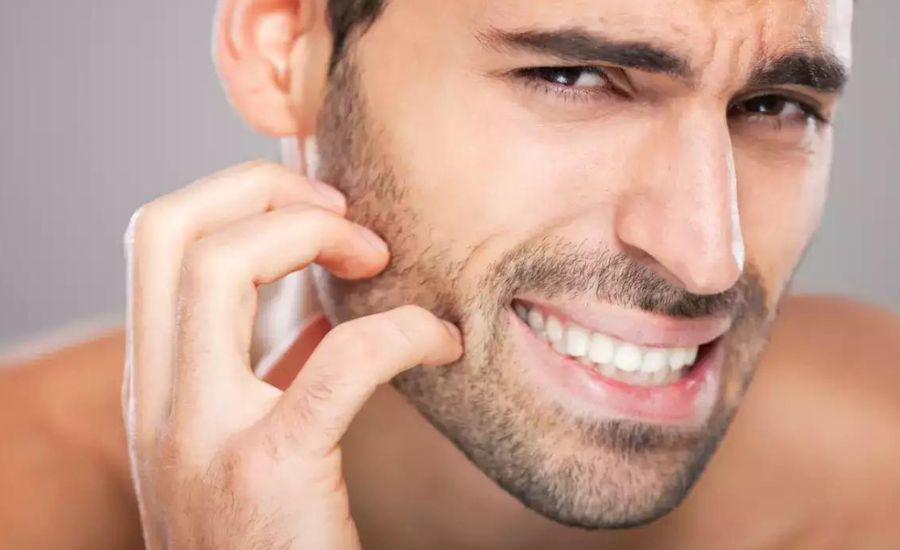 how to stop your beard from itching 3